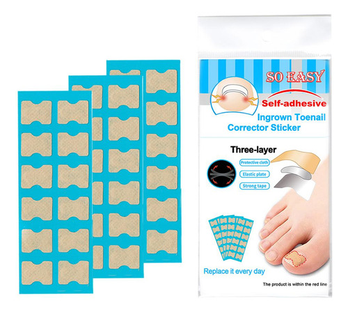Tiras De Pegatinas De Corrección De Uñas Kit De 36 Hojas