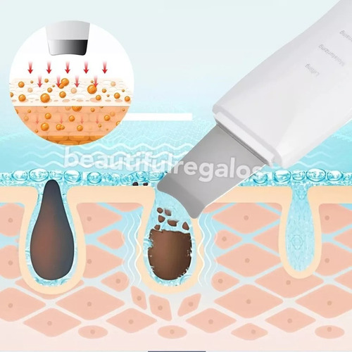 Espátula Facial Ultrasónica Peeling Skin Scrubber Recargable