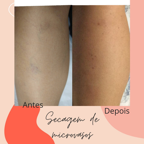 Imagem 4 de 5 de Forever Beautiful Estética