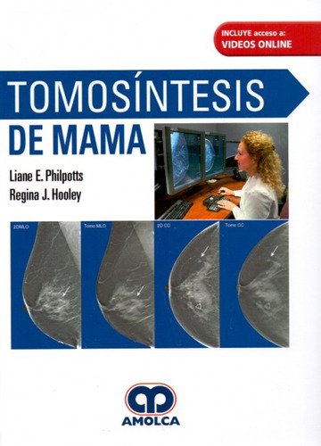 Philpotts Tomosíntesis De Mama 1era Ed. 2018!