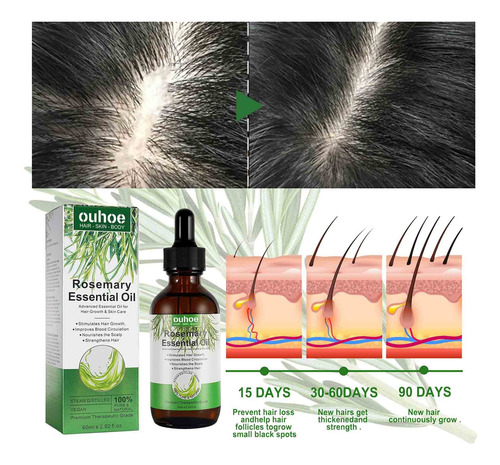 Esencia De Aceite Para El Cabello De Romero,aceite Esencial