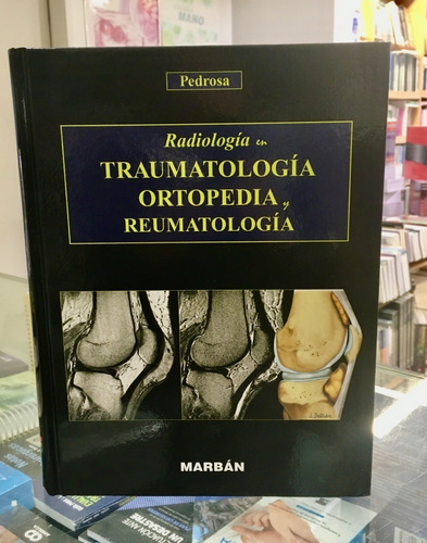 Pedrosa Radiología En Traumatología Ortopedia Y Reumatología
