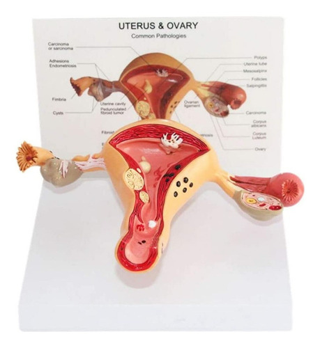 Modelo Anatómico De Útero Y Ovarios Modelo De Vagina Humana