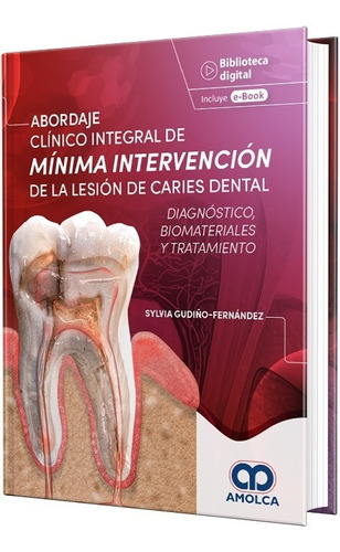 Abordaje Clín. Integ. Mínim Intervención De La Lesión Caries