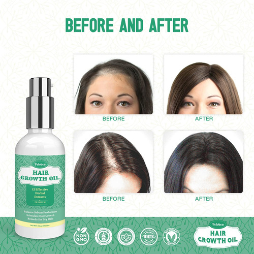Peloben Aceite Para El Crecimiento Del Cabello Para Un Cabe.