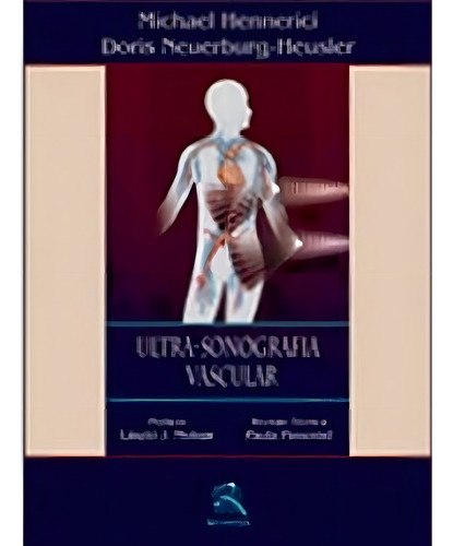 Ultra-sonografia Vascular, De Michael Hennerici. Editorial Thieme Revinter Em Português, 2003