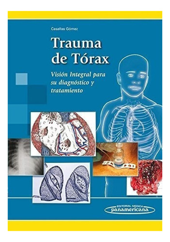 Trauma De Tórax. Visión Integral Para Su Diagnóstico Y Trata