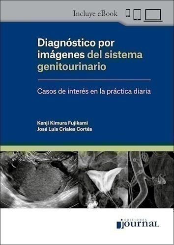 Diagnóstico Por Imágenes Del Sistema Genitourinario Casos D