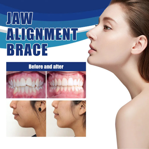 Alineación Mandibular De 3 Problemas, Solución: Pinza -
