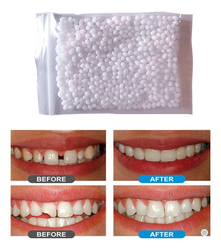 Resina Dental Moldeable Rk8p