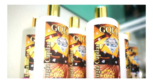 Imagen 2 de 5 de Cirugía Capilar, El Mejor Tratamiento Para Tu Cabello.