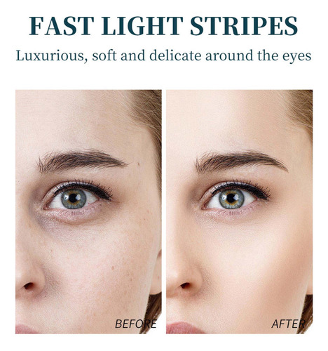 La Crema Para Ojos N Massage Es Elástica, Suave, Hidratante