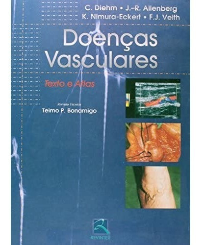 Livro - Doenças Vasculares - Texto E Atlas - Diehm Bfi