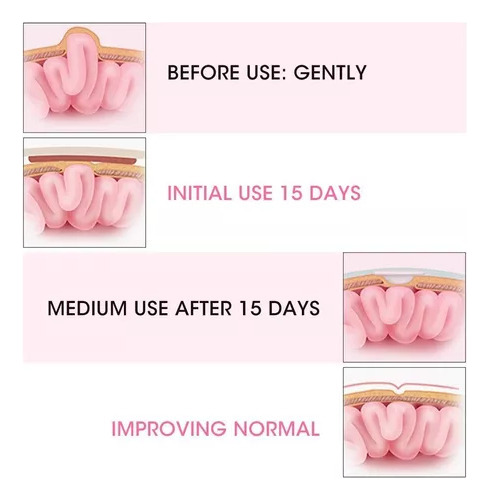 Banda Umbilical Belly B, Cinto De Hérnia De Umbigo Para Bebê