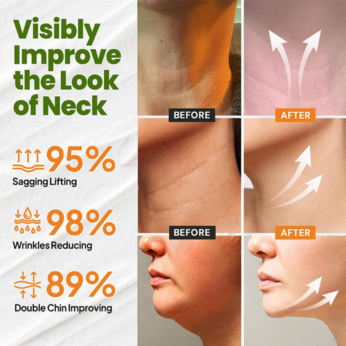 - 3×tighten & Lift Firming Neck Cream, Neck Firming Cream B