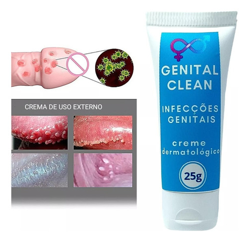Crema Elimina Candida, Vph, Herpes Genitales.