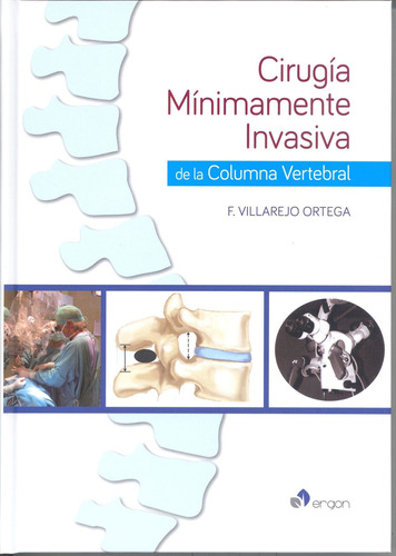 Cirugía Mínimamente Invasiva De La Columna Vertebral