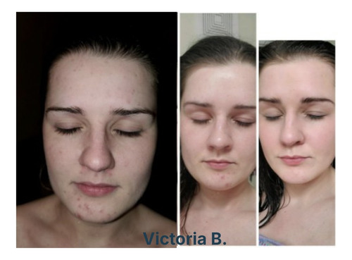 Neora Limpiador Desmaquillante De Rostro Botanico Vegano