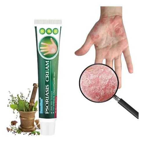 comprar Creme Pu002F Dermatite Atópica Alérgica Psoríase Eczema Coceira