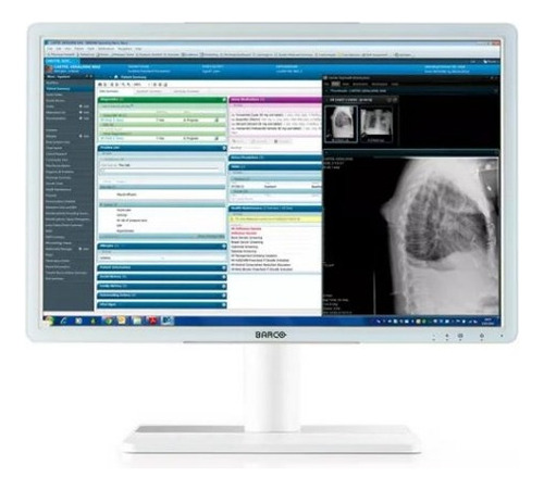 Monitor Barco Eonis 24 (mdrc2224 Wp)