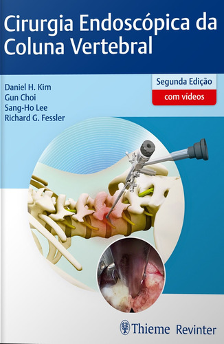 Cirurgia Endoscópica da Coluna Vertebral, de Kim, Daniel H.. Editora Thieme Revinter Publicações Ltda, capa dura em português, 2019