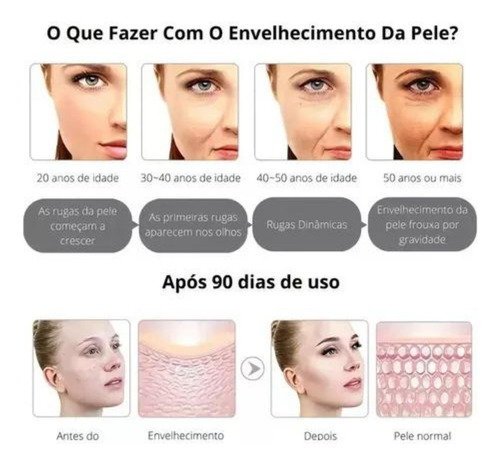 Ultrassom Microfocado Portatil Mini Hifu 3ªgeração 3.0 4em1