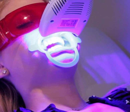 Imagen 3 de 10 de Blanqueamiento Dental Led +limpieza Dental + Fluor