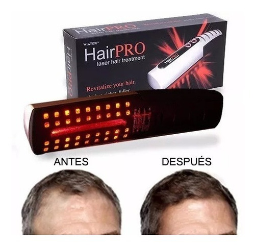 Hair Pro Terapia Laser Contra Caida Del Cabello