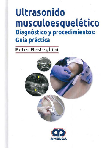 Libro Ultrasonido Musculoesquelético De Peter Resteghini