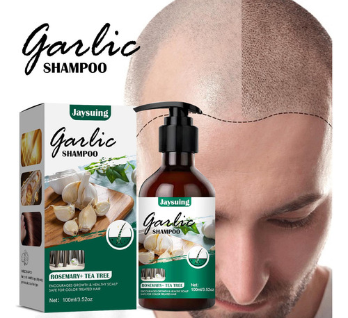 Qk Shampoo De Alho Sem Perfume Para Cabelos Normais A Secos