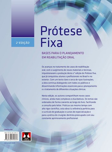 Prótese Fixa: Bases para o Planejamento em Reabilitação Oral, de Pegoraro, Luiz Fernando. Editorial Editora Artes MÉDicas Ltda., capa dura em português, 2013