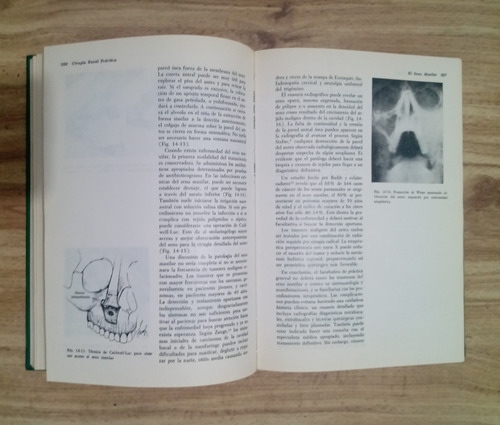 Libro De Cirugía Bucal Práctica - Daniel E. Waite (Usado)