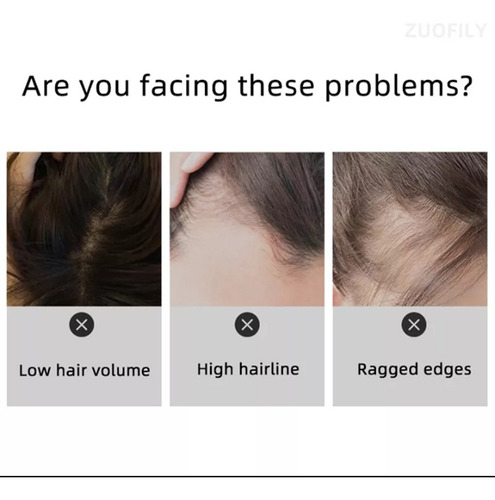 Imagen 5 de 10 de Polvo Cobertura De Raiz De Cabello Entradas Falta De Pelo