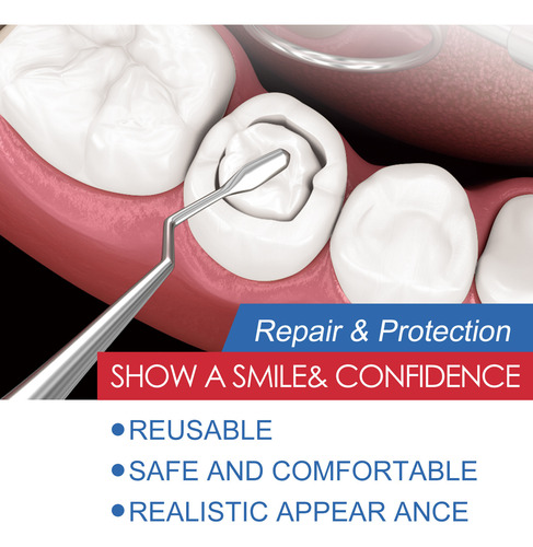 Adhesivo Para Empastes Dentales Kit De Reparación Temporal