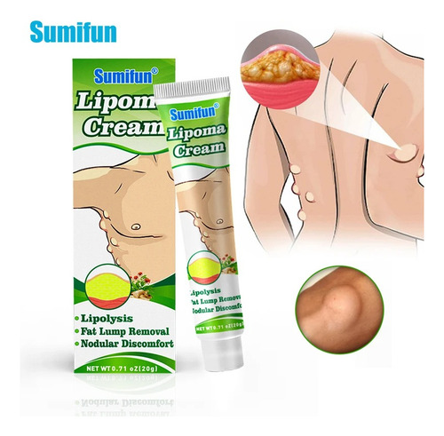 Crema Para Lipomas Elimina Pomada Alivio Aloe Vera