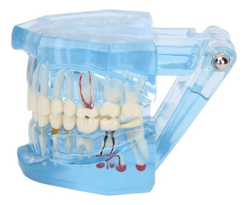 Youpin Dientes Dentales Modelo Acrílico Azul Transparente