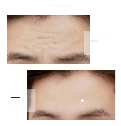 Turmeric Eye Cream Diminishing Fine Lines Around The Eyes Da
