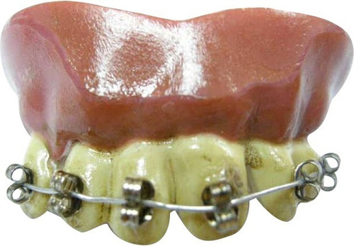 Dientes Falsos Con Brackets Halloween Fiesta Disfraz 530109 | MercadoLibre Dientes Falsos Con Brackets Halloween Fiesta Disfraz 530109 | MercadoLibre