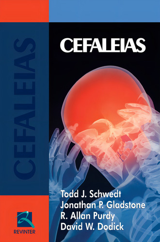 Cefaleias, de Schwedt, Todd J.. Editorial Thieme Revinter Publicações Ltda, capa mole em português, 2012