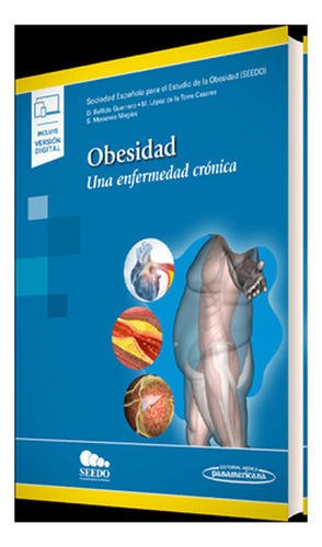 Obesidad. Una Enfermedad Crónica. Incluye Hevook