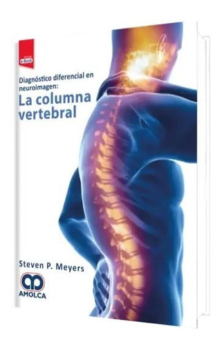 Diagnóstico Diferencial En Neuroimagen La Columna Vertebral