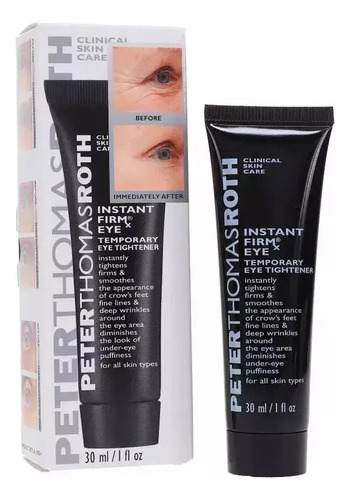 Fb Apriete Temporal Peter Firmx Para Ojos, 30 Ml, Roth