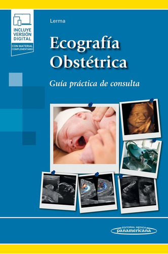 Ecografia Obstetrica Y E Book - Lerma Puertas, Diego