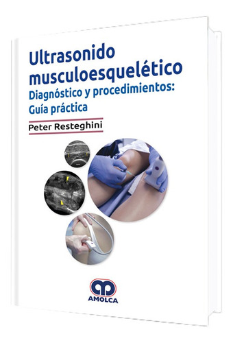 Ultrasonido Musculoesquelético Diagnóstico Y Procedimientos.