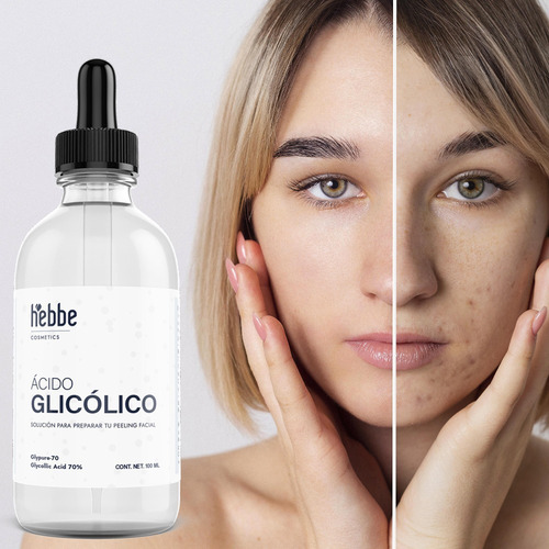 Imagen 2 de 10 de Ácido Glicólico Cosmético 70% Líquido 100 Ml (rinde 1 L)