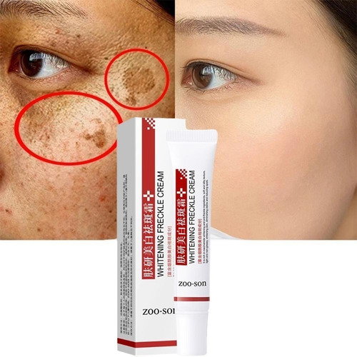 Pomada Reparadora Facial Clareamento Manchas Sardas Melasma