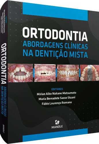 Ortodontia Abrodagens Clínicas Na Dentição Mista