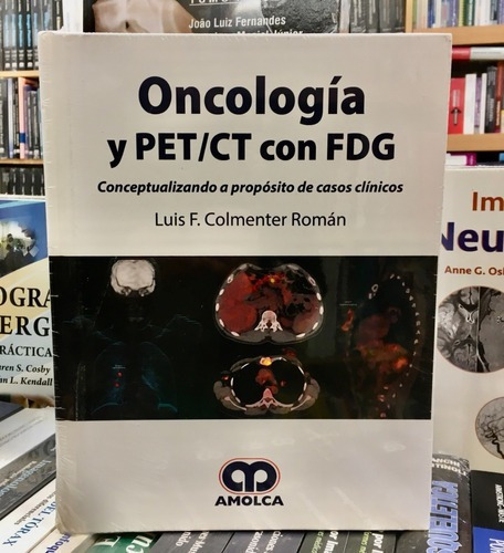 Oncologa Y Petct Con Fdg Concepto A Propsito De Ca,jk