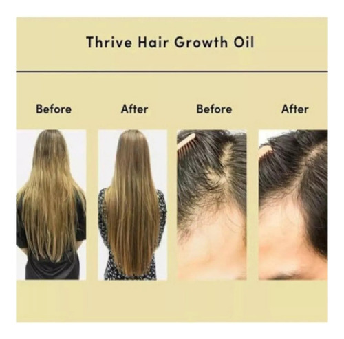 Para 4pcs Aceite Esencial Para Cuidado Del Cabello Veganic