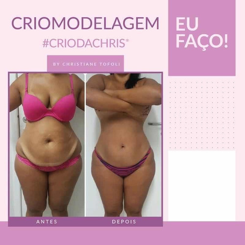 Imagem 4 de 5 de Criomodelagem
